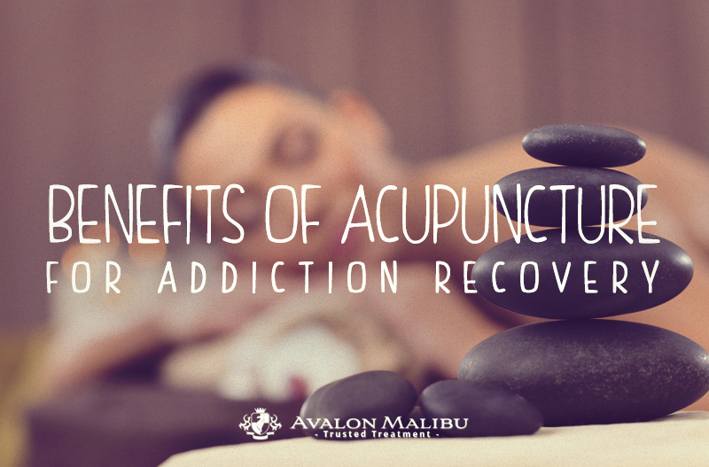 Benefits Of Acupuncture Therapy For Addiction Recovery - AvalonMalibu