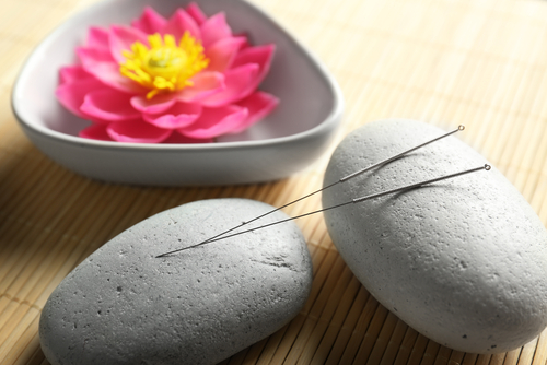 acupuncture needles on stones