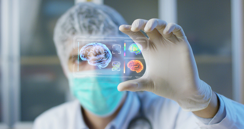 Doctor holding brain scan