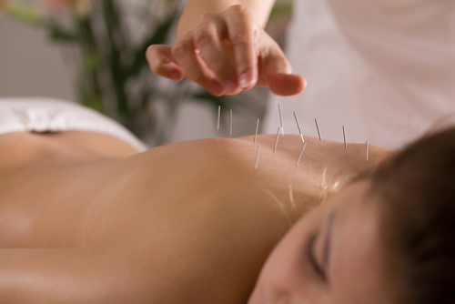 The Most Common Fears of Acupuncture, Debunked