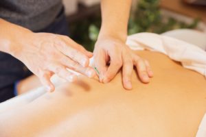 How Acupuncture Can Help Healing
